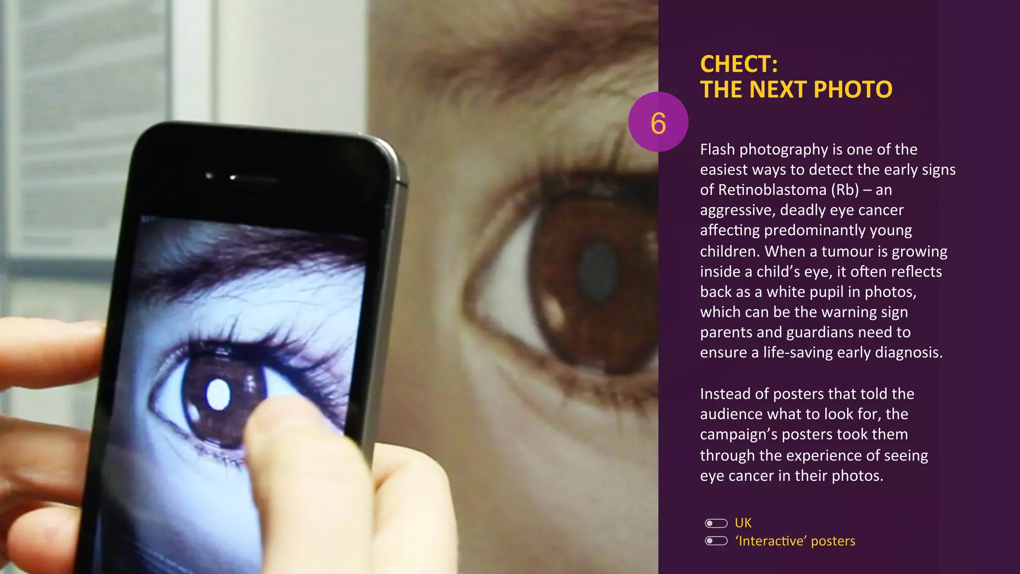 Flash	
  photography	
  is	
  one	
  of	
  the	
  
easiest	
  ways	
  to	
  detect	
  the	
  early	
  signs	
  
of	
  ReAnoblastoma	
  (Rb)	
  –	
  an	
  
aggressive,	
  deadly	
  eye	
  cancer	
  
aﬀecAng	
  predominantly	
  young	
  
children.	
  When	
  a	
  tumour	
  is	
  growing	
  
inside	
  a	
  child’s	
  eye,	
  it	
  ogen	
  reﬂects	
  
back	
  as	
  a	
  white	
  pupil	
  in	
  photos,	
  
which	
  can	
  be	
  the	
  warning	
  sign	
  
parents	
  and	
  guardians	
  need	
  to	
  
ensure	
  a	
  life-­‐saving	
  early	
  diagnosis.	
  
	
  
Instead	
  of	
  posters	
  that	
  told	
  the	
  
audience	
  what	
  to	
  look	
  for,	
  the	
  
campaign’s	
  posters	
  took	
  them	
  
through	
  the	
  experience	
  of	
  seeing	
  
eye	
  cancer	
  in	
  their	
  photos.	
  
CHECT:	
  
THE	
  NEXT	
  PHOTO	
  
‘InteracAve’	
  posters	
  
UK	
  
6
 