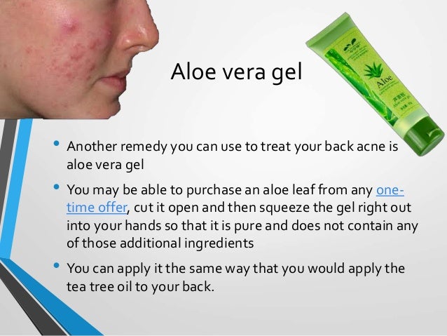 back acne aloe vera