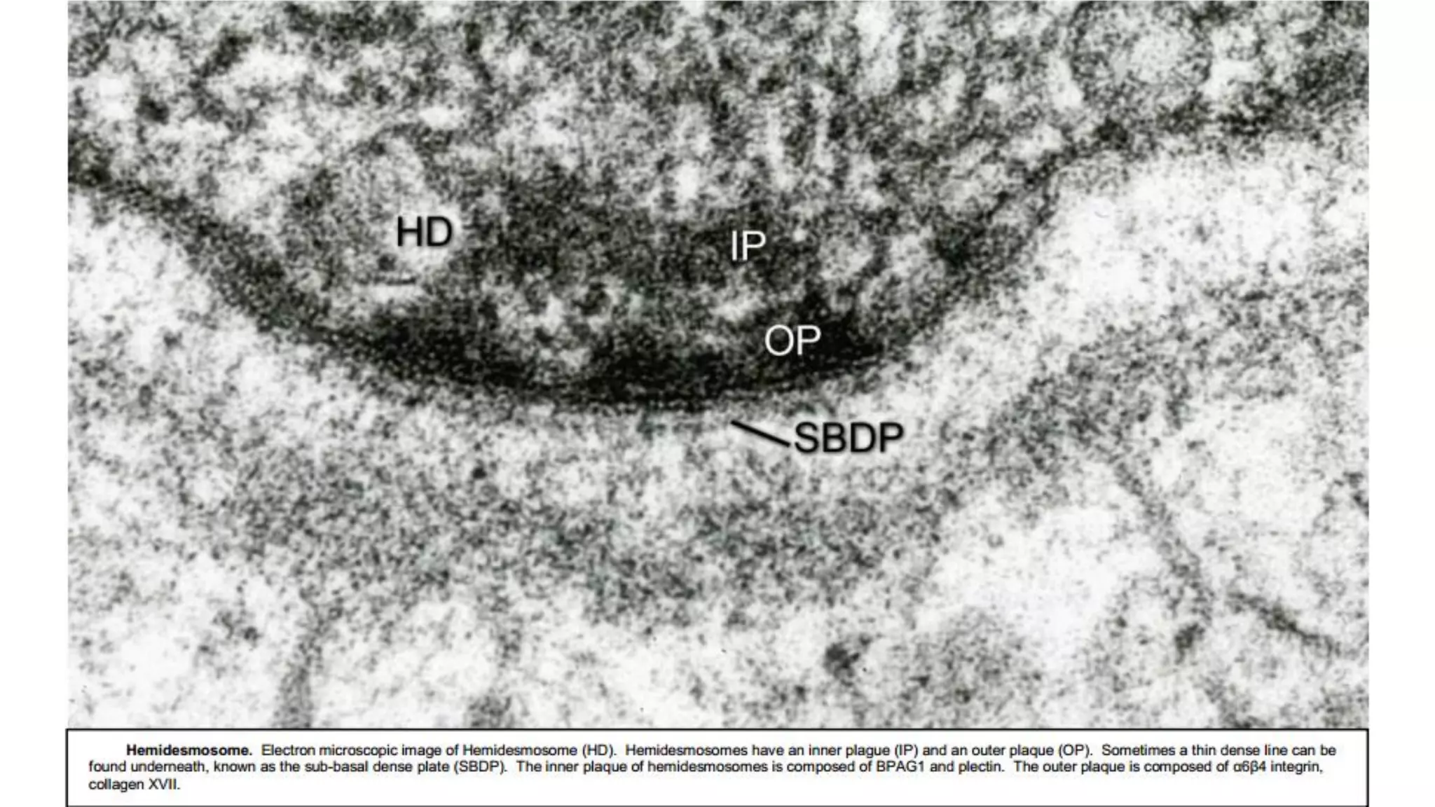 The Biology of the Basement Membrane Zone | PDF