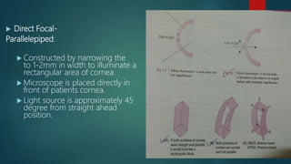  Direct Focal-
Parallelepiped:
 Constructed by narrowing the
to 1-2mm in width to illuminate a
rectangular area of cornea.
 Microscope is placed directly in
front of patients cornea.
 Light source is approximately 45
degree from straight ahead
position.
 