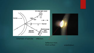 Schematic of specular reflection.
Reflection from
front surface endothelium
 