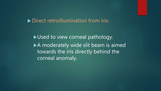  Direct retroillumination from iris:
Used to view corneal pathology.
A moderately wide slit beam is aimed
towards the iris directly behind the
corneal anomaly.
 