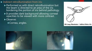  Indirect retroillumination from iris:
 Performed as with direct retroillumination but
the beam is directed to an area of the iris
bordering the portion of iris behind pathology.
 It provides dark background allowing corneal
opacities to be viewed with more contrast.
 Observe:
Cornea, angles.
 