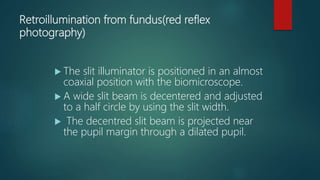 Retroillumination from fundus(red reflex
photography)
 The slit illuminator is positioned in an almost
coaxial position with the biomicroscope.
 A wide slit beam is decentered and adjusted
to a half circle by using the slit width.
 The decentred slit beam is projected near
the pupil margin through a dilated pupil.
 