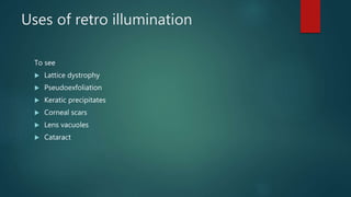 Uses of retro illumination
To see
 Lattice dystrophy
 Pseudoexfoliation
 Keratic precipitates
 Corneal scars
 Lens vacuoles
 Cataract
 