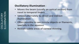 OSCILLATORY
ILLUMINATION
 