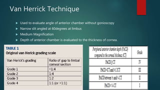 Van Herrick Technique
 Used to evaluate angle of anterior chamber without gonioscopy
 Narrow slit angled at 60degrees at limbus
 Medium Magnification
 Depth of anterior chamber is evaluated to the thickness of cornea.
 