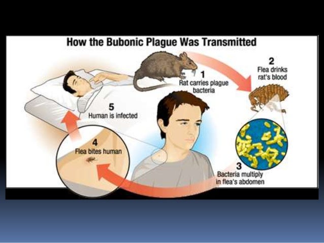 an analysis of the history symptoms cause and mortality of the bubonic plague Was the black death just bubonic plague update cancel answer wiki 5 answers a hundred million corpses broadcast through history are no more than a puff of smoke in the imagination this is the bacteria that causes the black plague/bubonic plague. an analysis of the history symptoms cause and mortality of the bubonic plague Was the black death just bubonic plague update cancel answer wiki 5 answers a hundred million corpses broadcast through history are no more than a puff of smoke in the imagination this is the bacteria that causes the black plague/bubonic plague.