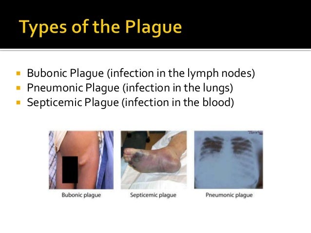 Lymph Project - Three Points Lymph Project - Three Points