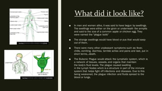 What did it look like?
■ In men and women alike, it was said to have begun by swellings.
The swellings were either on the groin or underneath the armpits
and said to the size of a common apple or chicken egg. They
were named the "plague boils"
■ The strange swellings would have blood or pus that would seep
out of them.
■ There were many other unpleasant symptoms such as: fever,
chills, vomiting, diarrhea, terrible aches and pains and last, put in
short terms...death.
■ The Bubonic Plague would attack the Lymphatic system, which is
a network of tissues, vessels, and organs that maintain
the body's fluid levels. The plague caused swelling
in the Lymph Nodes which is a structure in part of the immune
system that helps fight off infections and diseases. Due to this
being weakened, the plague infection and fluids spread to the
blood or lungs.
This Photo by Unknown author is licensed under CC BY-SA.
This Photo by Unknown author is licensed under CC BY-SA-NC.
 