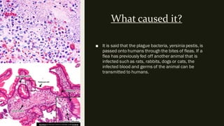 What caused it?
■ It is said that the plague bacteria, yersinia pestis, is
passed onto humans through the bites of fleas. If a
flea has previously fed off another animal that is
infected such as rats, rabbits, dogs or cats, the
infected blood and germs of the animal can be
transmitted to humans.
This Photo by Unknown author is licensed underCC BY-SA.
 