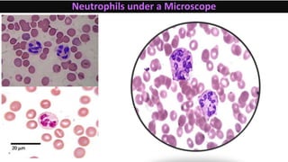 Neutrophils under a Microscope
 