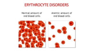 ERYTHROCYTE DISORDERS
 