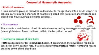 Congenital Haemolytic Anaemias
• Sickle cell anaemia:
It is an inherited group of disorders, red blood cells change shape into a sickle shape. The
cells die early, leaving a shortage of healthy red blood cells (sickle cell anaemia) and can
block blood flow causing pain (sickle cell crisis).
• Thalassaemia:
Thalassemia is an inherited blood disorder characterized by less oxygen-carrying protein
(haemoglobin) and fewer red blood cells in the body than normal.
• Haemolytic disease of new born:
(HDN) is a blood disorder in newborn babies. It occurs when the new born’s red blood
cells break down at a fast rate. It's also called erythroblastosis fetalis. Hemolytic means
breaking down of red blood cells
 