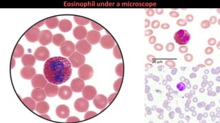 Eosinophil under a microscope
 