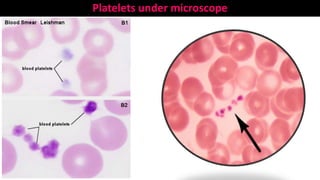 Platelets under microscope
 