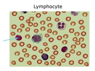 Lymphocyte 
 