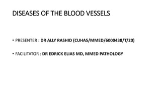 DISEASES OF THE BLOOD VESSELS
• PRESENTER : DR ALLY RASHID (CUHAS/MMED/6000438/T/20)
• FACILITATOR : DR EDRICK ELIAS MD, MMED PATHOLOGY
 