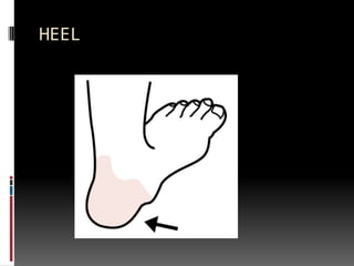 HEEL