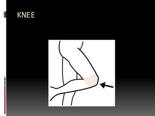 KNEE