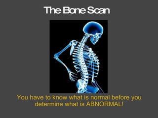 The Bone Scan You have to know what is normal before you determine what is ABNORMAL! 