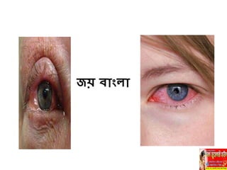 েয় বািংলা
 