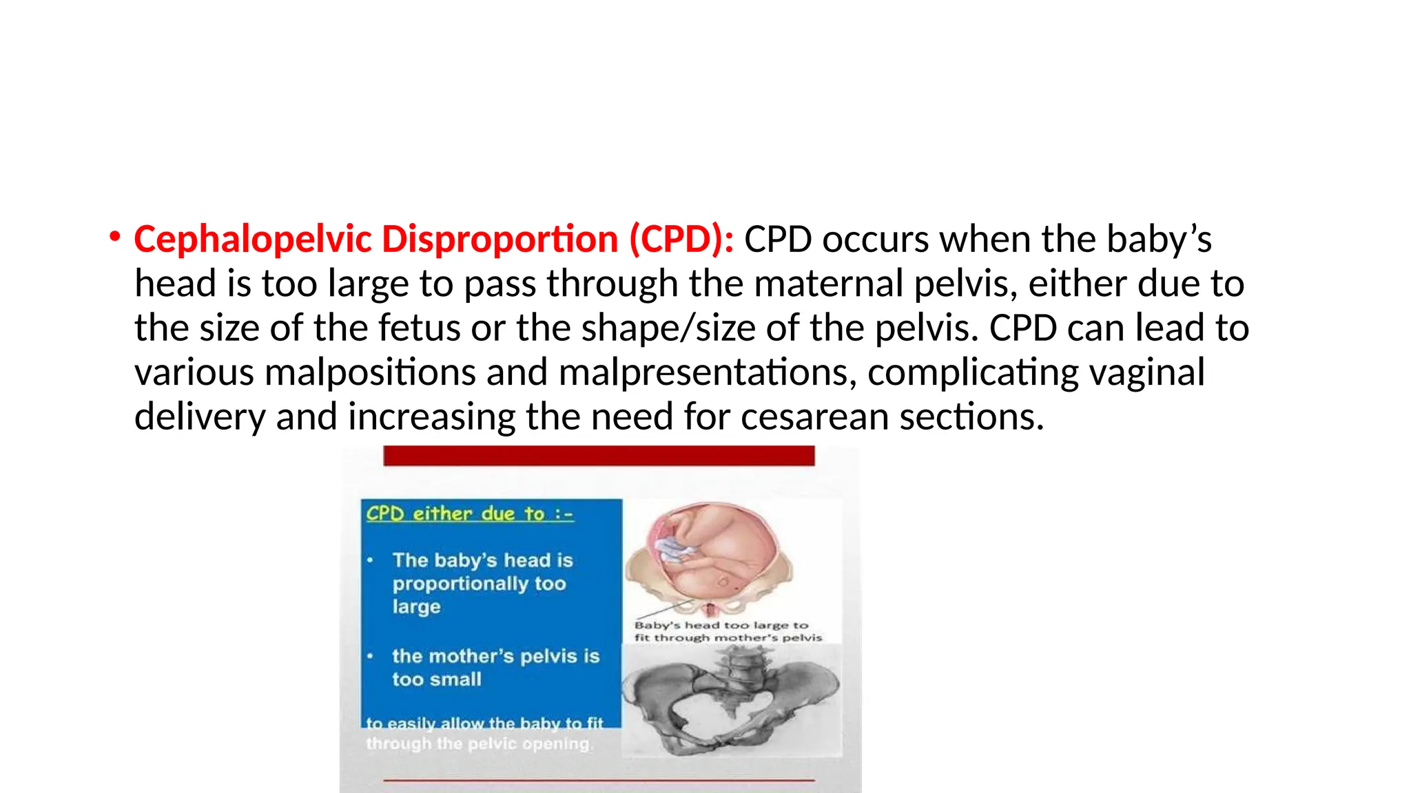 Cpd Sign THE BONY PELVIS and it's significance.pptx
