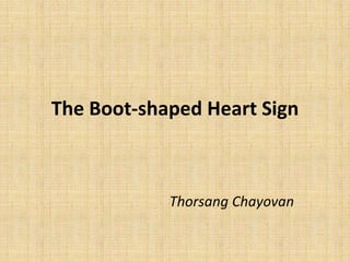 The Boot-shaped Heart Sign
Thorsang Chayovan
 