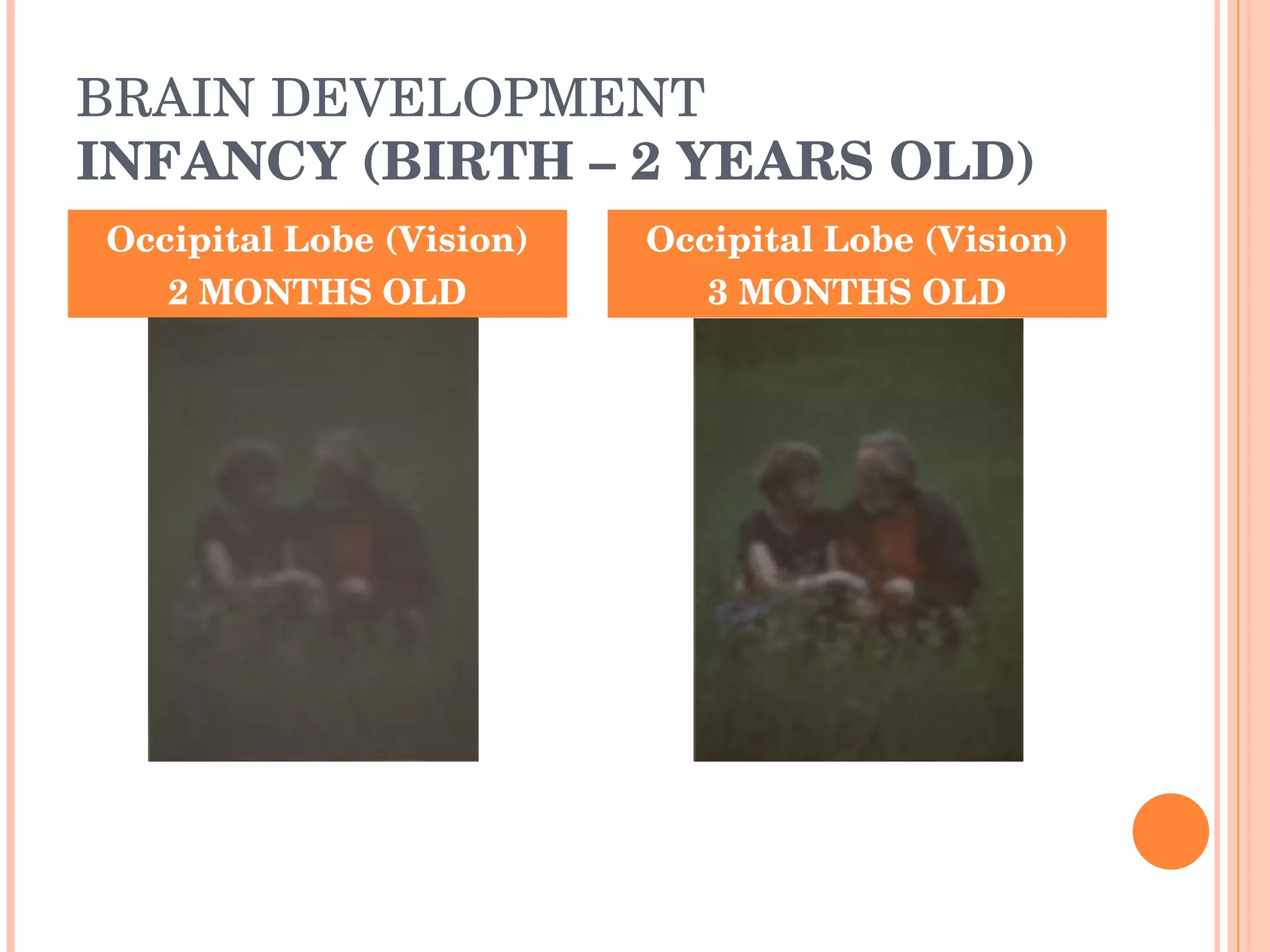 BRAIN DEVELOPMENT INFANCY (BIRTH – 2 YEARS OLD) Occipital Lobe (Vision) 2 MONTHS OLD Occipital Lobe (Vision) 3 MONTHS OLD 