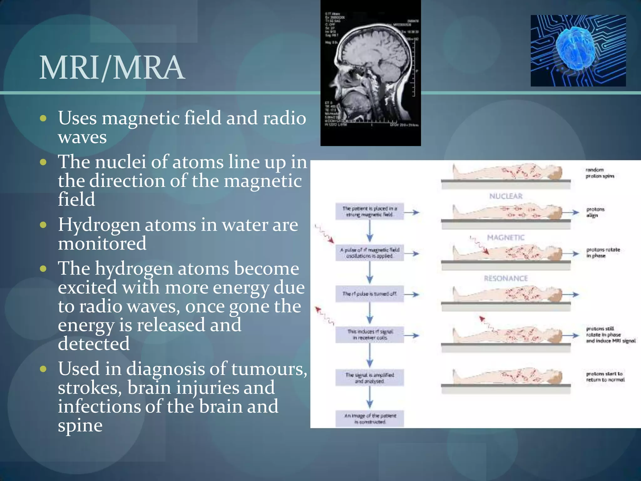 The brain - scans and imaging | PPTX