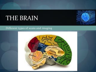 Different types of scans and imaging The Brain 