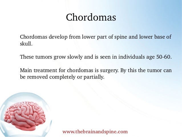 Brain Tumor And Its Types