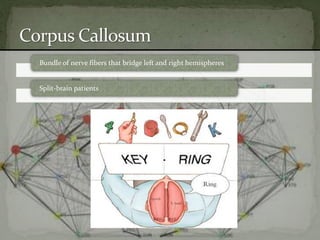 Bundle of nerve fibers that bridge left and right hemispheres
Split-brain patients
 