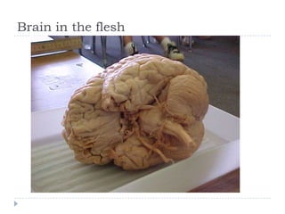 Brain in the flesh