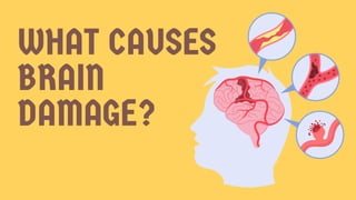 WHAT CAUSES
BRAIN
DAMAGE?
 