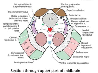 Section through upper part of midbrain
 