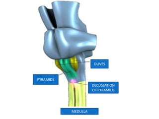 OLIVES
DECUSSATION
OF PYRAMIDS
PYRAMIDS
MEDULLA
 