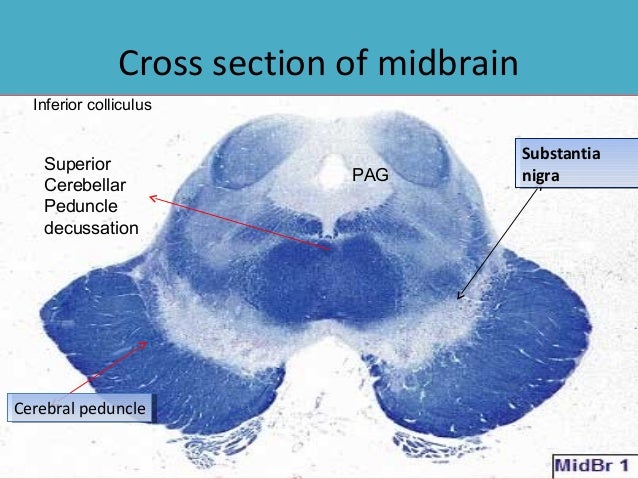 The brain stem ii
