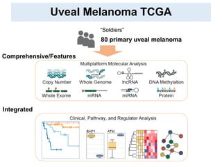Uveal Melanoma TCGA
80 primary uveal melanoma
Comprehensive/Features
Integrated
“Soldiers”
 