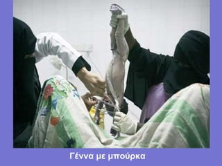 Γέννα με μπούρκα
 