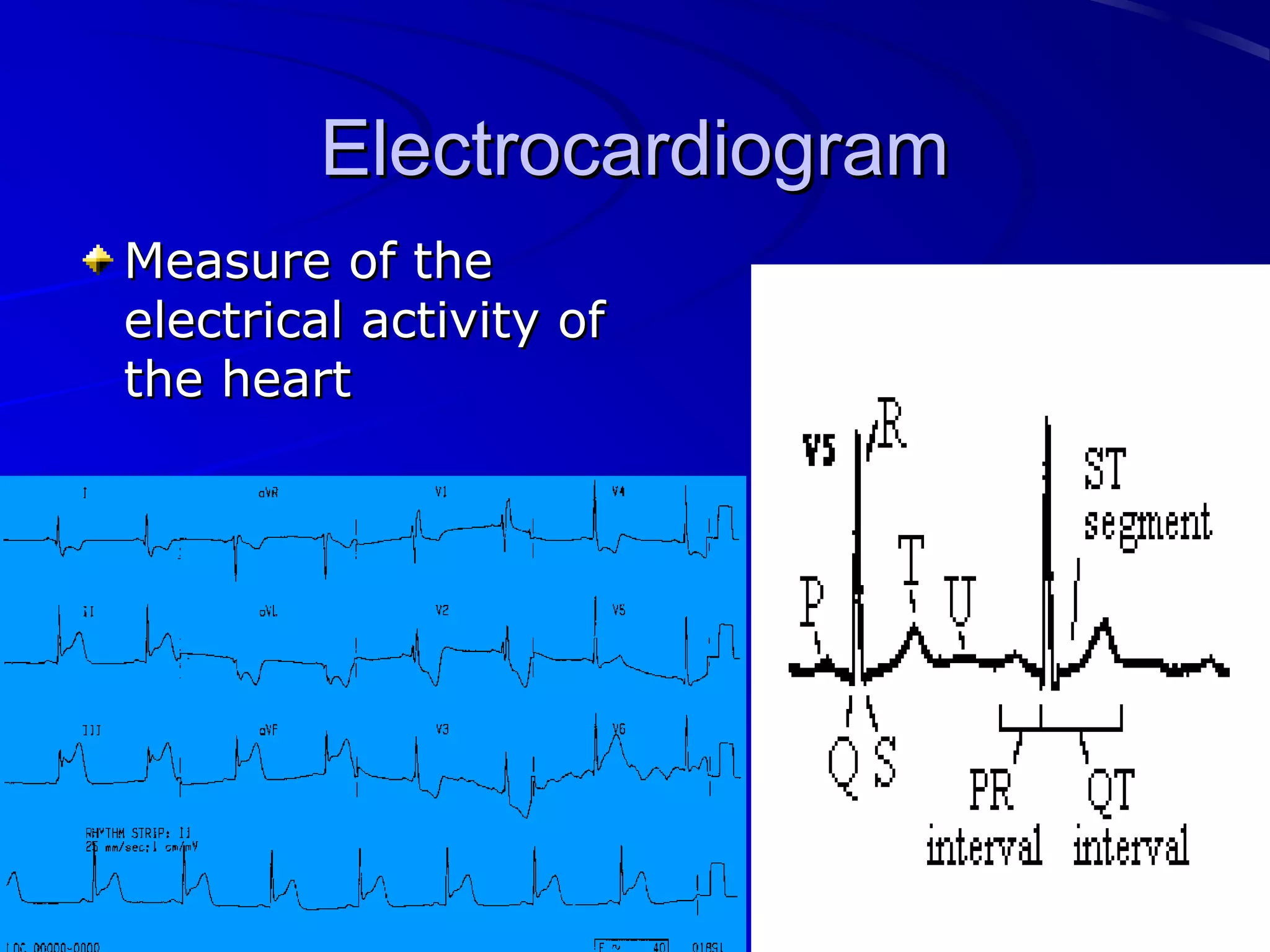 ElectrocardiogramElectrocardiogram
Measure of theMeasure of the
electrical activity ofelectrical activity of
the heartthe heart
 
