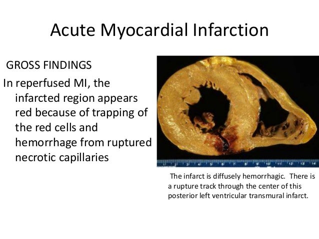 The Cardiovascular System Part 1
