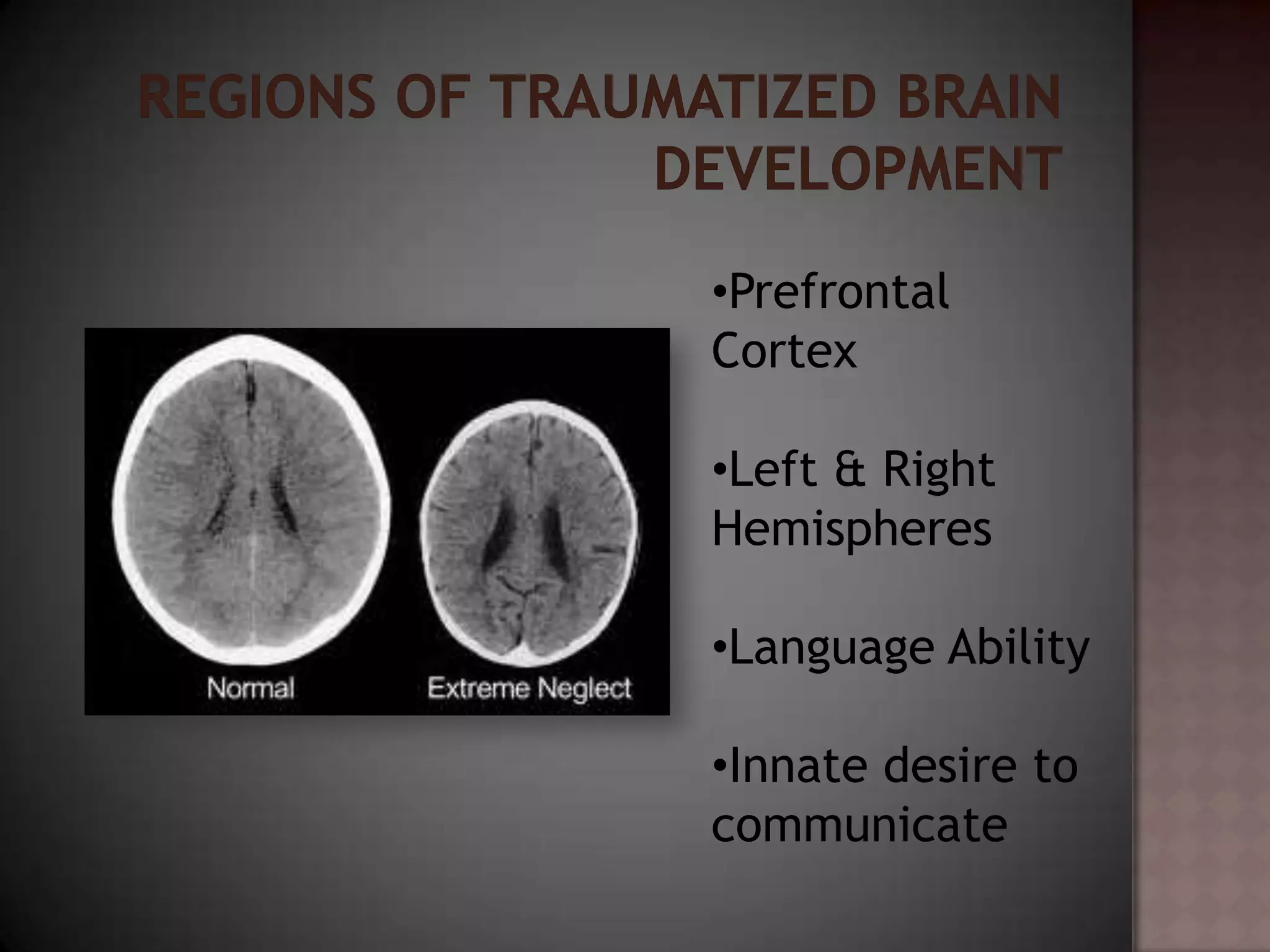 •Prefrontal
Cortex

•Left & Right
Hemispheres

•Language Ability

•Innate desire to
communicate
 