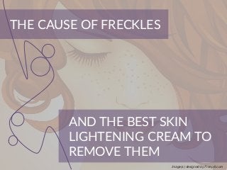 AND THE BEST SKIN
LIGHTENING CREAM TO
REMOVE THEM
THE CAUSE OF FRECKLES
Image(s) designed by Freepik.com
 