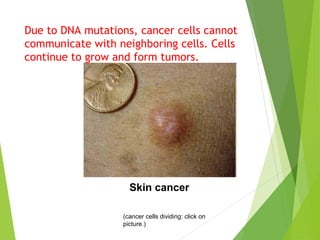 Due to DNA mutations, cancer cells cannot 
communicate with neighboring cells. Cells 
continue to grow and form tumors. 
Skin cancer 
(cancer cells dividing: click on 
picture.) 
 