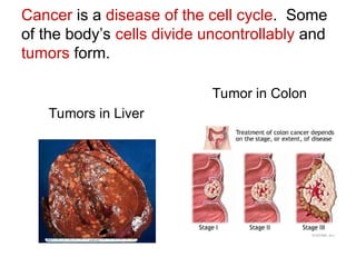 Role of The Cell Cycle and modulation in Cancer.ppt