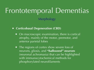 Frontotemporal Dementias Corticobasal Degeneration (CBD) On macroscopic examination, there is cortical atrophy, mainly of the motor, premotor, and anterior parietal lobes The regions of cortex show severe loss of neurons, gliosis, and  “ballooned” neurons  (neuronal achromasia) that can be highlighted with immunocytochemical methods for phosphorylated neurofilaments Morphology 