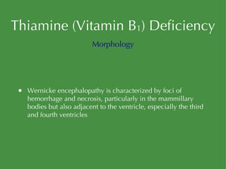 Thiamine (Vitamin B 1 ) Deficiency Wernicke encephalopathy is characterized by foci of hemorrhage and necrosis, particularly in the mammillary bodies but also adjacent to the ventricle, especially the third and fourth ventricles Morphology 