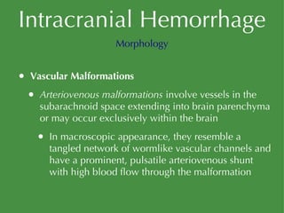 Intracranial Hemorrhage Vascular Malformations Arteriovenous malformations  involve vessels in the subarachnoid space extending into brain parenchyma or may occur exclusively within the brain In macroscopic appearance, they resemble a tangled network of wormlike vascular channels and have a prominent, pulsatile arteriovenous shunt with high blood flow through the malformation Morphology 