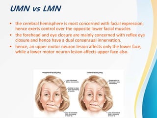 UMN vs LMN
• the cerebral hemisphere is most concerned with facial expression,
hence exerts control over the opposite lower facial muscles
• the forehead and eye closure are mainly concerned with reflex eye
closure and hence have a dual consensual innervation.
• hence, an upper motor neuron lesion affects only the lower face,
while a lower motor neuron lesion affects upper face also.
 
